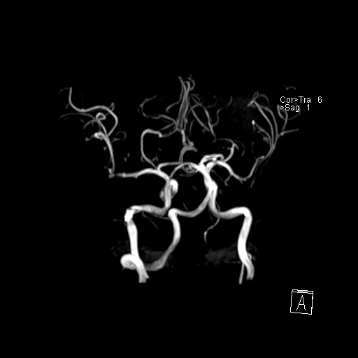 Click on the Serie image to view the images of VILLANUEVA, WILLIAM A.